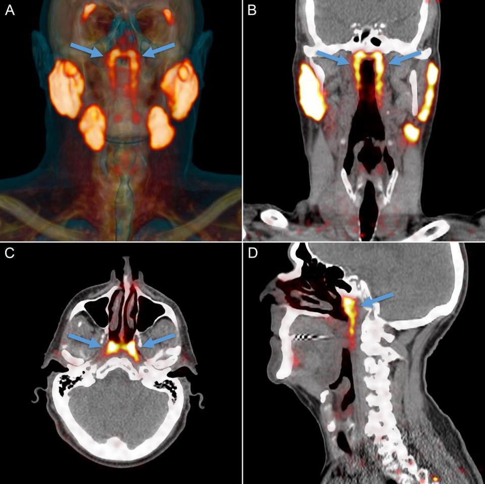 Photo credit: Valstar, et. al./Radiotherapy and Oncology