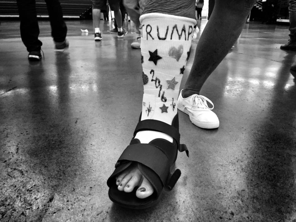 <p>A woman with a cast decorated in support of Donald Trump at a campaign rally on May 25 in Anaheim, Calif. (Photo: Holly Bailey/Yahoo News) </p>