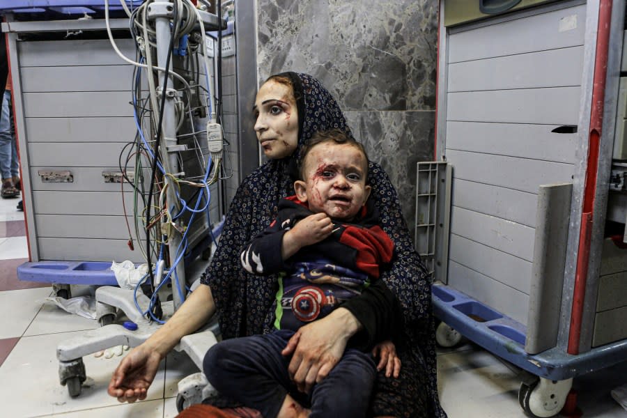 Wounded Palestinians wait for treatment, at the al-Shifa hospital, in Gaza City, central Gaza Strip, Tuesday, Oct. 17, 2023. (AP Photo/Abed Khaled)