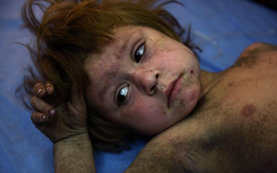 A little girl named Amina was found by Iraqi Army soldiers when they heard her cries from the rubble. She was believed to be a foreigner and spoke Russian. - Credit: Carol Guzy/Rex