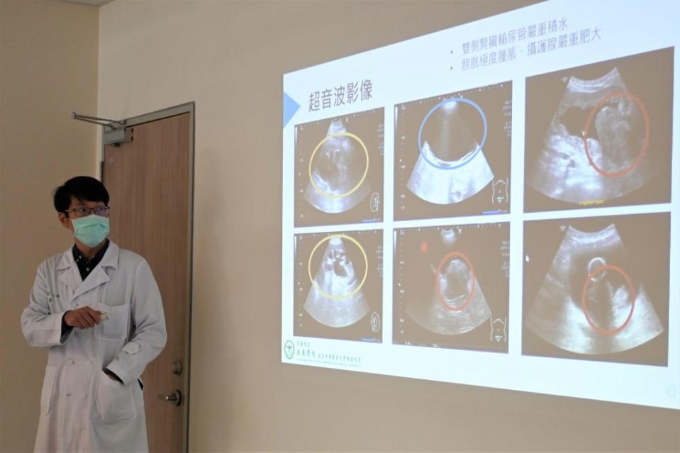 董聖雍指出，楊翁的攝護腺體積遠超常人明顯肥大，膀胱也有極度腫脹情形。(安南醫院提供)
