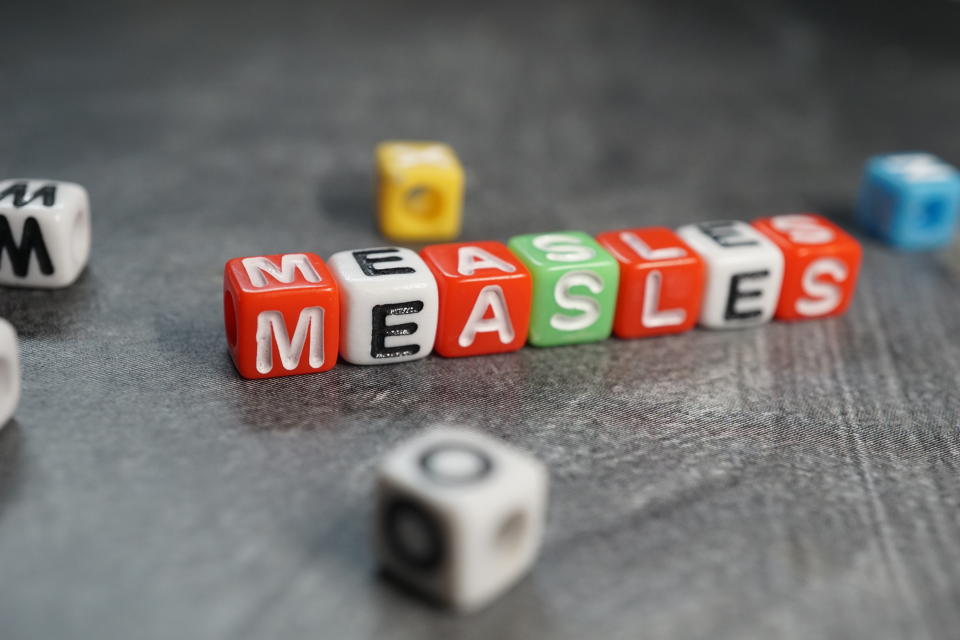 A second measles case has been confirmed in the Greater Toronto Area, according to public health agencies. (Photo via Getty Images)