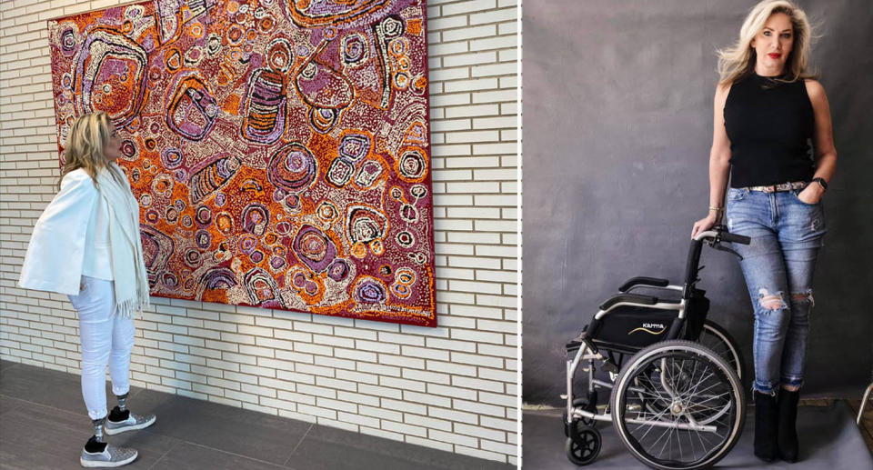 Stephenie Rodriguez pictured with her new prosthetics and standing next to her wheelchair.