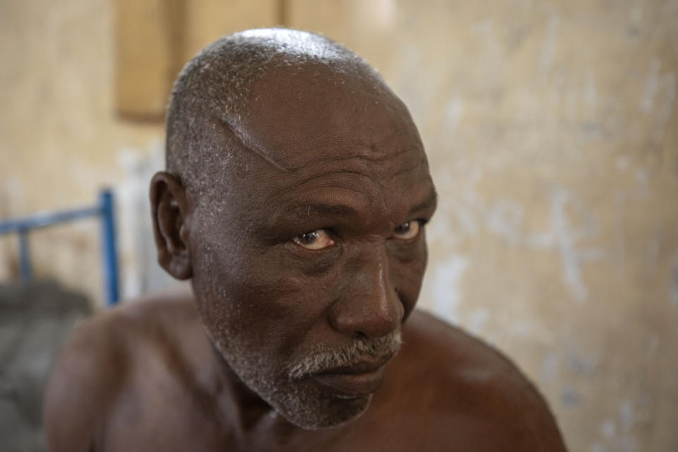 Gebremedhin Gebru, 65-year-old farmer and Tigrayan survivor from Ruwasa, Ethiopia, shows his wounds, inside a shelter, at the Hamdeyat Transition Center near the Sudan-Ethiopia border, eastern Sudan, Tuesday, Dec. 15, 2020. Gebru, was shot while trying to run from Amhara militia members in his town of Ruwasa. He said he lay for two days until a neighbor found him. "People will be hit if they are seen helping the wounded," he said. (AP Photo/Nariman El-Mofty)