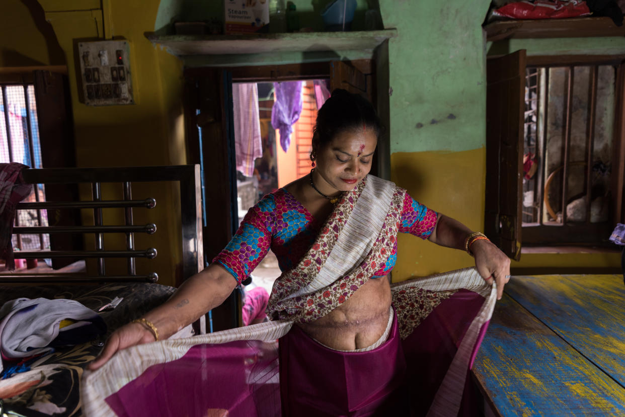 Sathi, wearing a bodice and underskirt, unwinds her sari to show the scars on her belly, in a room decorated in colorful shades of aqua and yellow.
