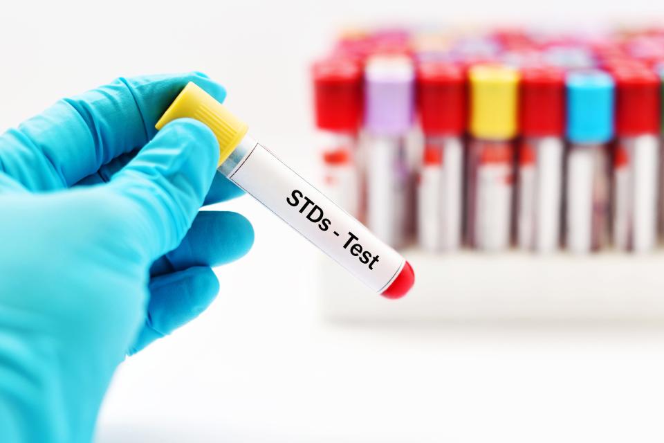 Experts say everyone, including those in relationships, need to consider STD testing.