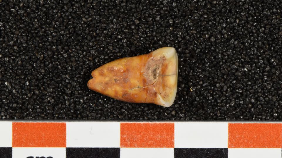 A human tooth excavated from Taforalt Cave in Morocco shows severe wear and decay, or cavities.  -Heiko Temming
