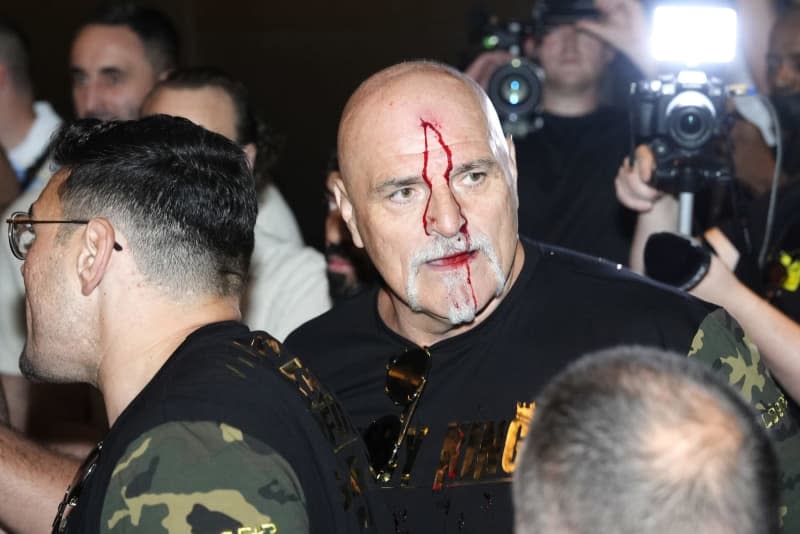 John Fury, father of the British boxer Tyson Fury, with blood on his face during a media day in Riyagh. The IBF, WBA, WBC and WBO heavyweight title fight between Tyson Fury and Oleksandr Usyk will take place on Saturday 18th May. Nick Potts/PA Wire/dpa