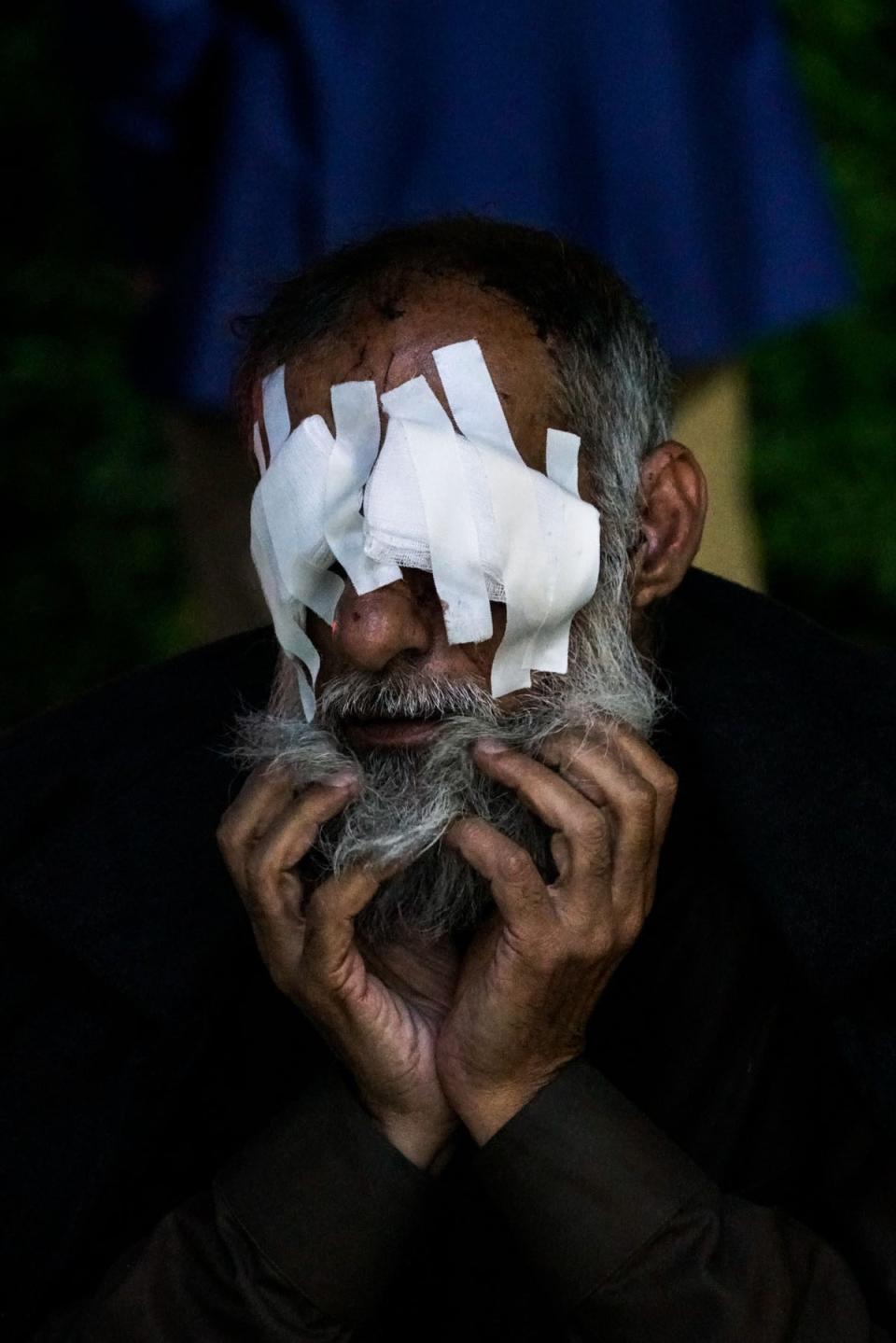 Adnan Thanon Younis was blinded by an exploding shell in Mosul (Peter van Agtmael/Magnum Photos)