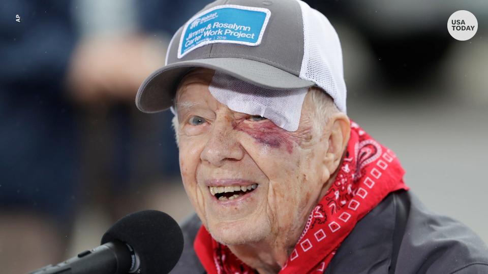 Former President Jimmy Carter hospitalized after fracturing pelvis, in 'good spirits'
