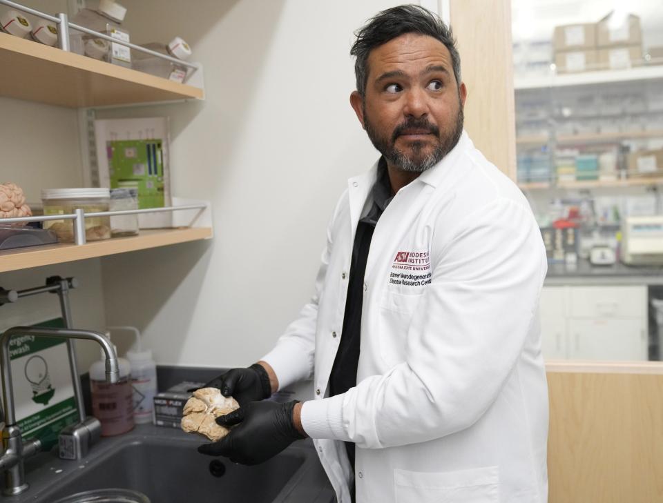 ASU professor Diego Mastroeni holds a normal brain from a 90-year-old woman at the Arizona State University’s Biodesign Institute in Tempe, Ariz., on Feb. 22, 2023.