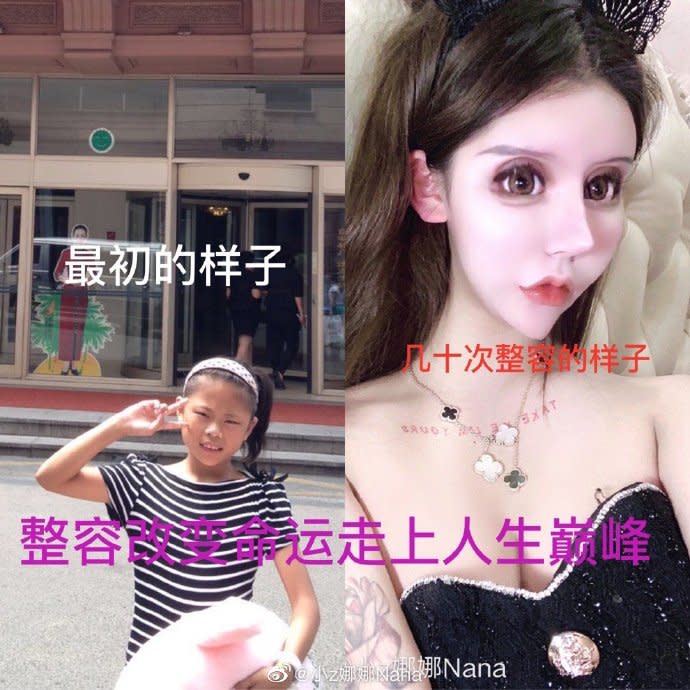 小z娜娜透露，為了成為芭比娃娃，自己從13歲就開始整型。（圖／翻攝自小z娜娜微博）