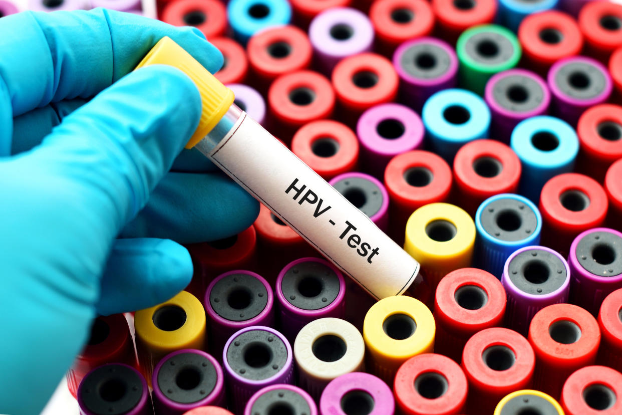 Blood sample for HPV test