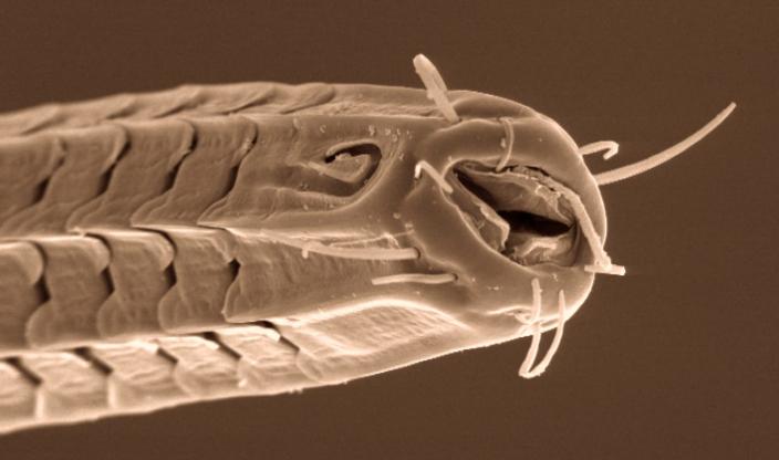 Imagen microscópica del nematodo Ceramonema.