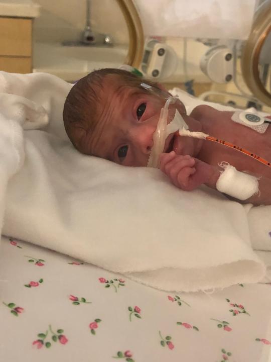 Micro-preemie Andi Burdine at 22 days old in the neonatal intensive care until. "I love this pic because it was one of the first time I felt like she was actually seeing me," the baby's mom, News 2 anchor Nikki Burdine, said.