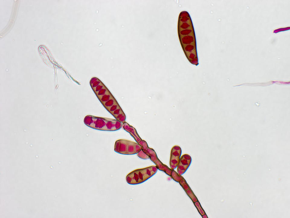 FILE - This undated file image made available by The Centers for Disease Control and Prevention shows the Exserohilum rostratum fungus. Exserohilum, a kind of black mold, is the primary cause of a number of fungal meningitis cases afflicting people who got steroid back injections for pain. There are numerous ways a fungus might contaminate medications being made in a lab. (AP Photo/The Centers for Disease Control, File)