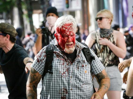 A right-wing protester after being attacked in Portland's Pioneer Courthouse Square on 29 June (Moriah Ratner/Getty Images)