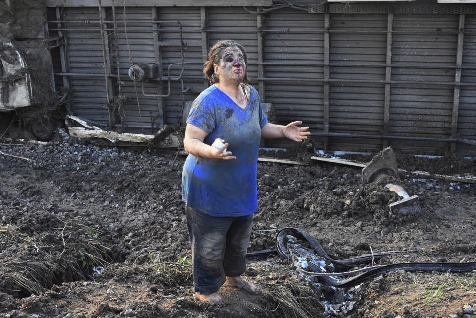 <p>A reacts after part of a train derailed, a village in Tekirdag province, northwestern Turkey, July 8, 2018. (Photo: Mehmet Yirun/DHA-Depo Photos via AP) </p>