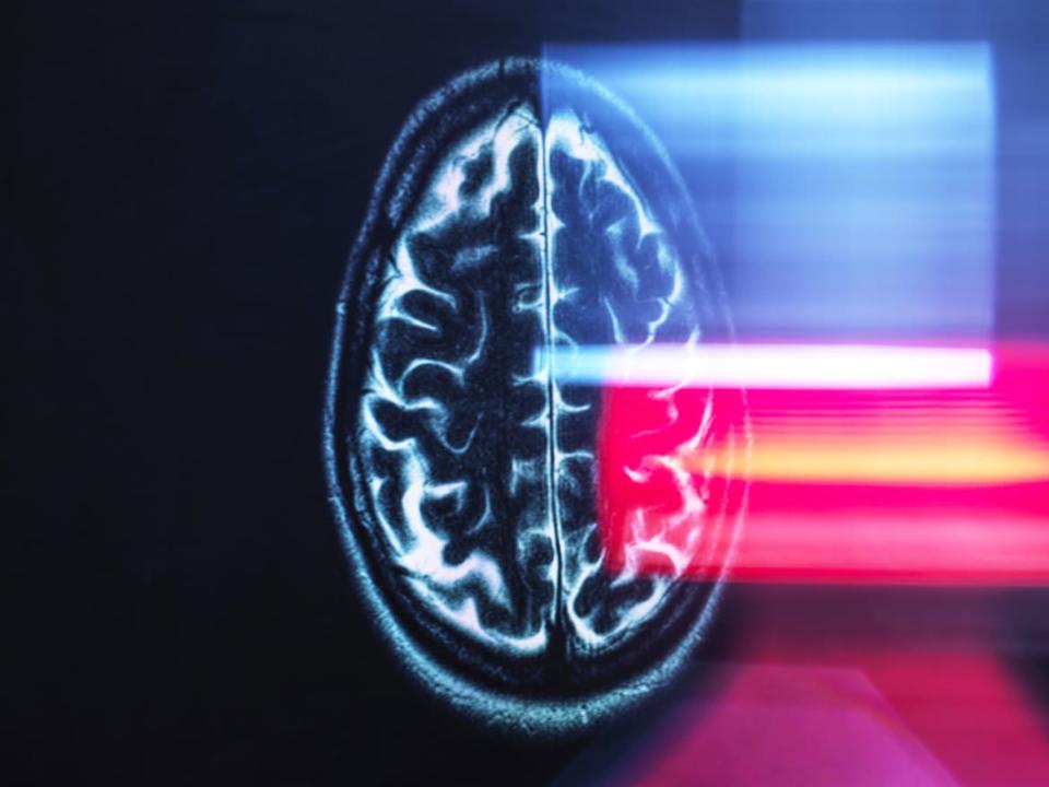 <div class="inline-image__caption"><p>James Heathers’ work seems to suggest the promising cognitive data behind simufilam’s Phase 2 results is far from airtight. </p></div> <div class="inline-image__credit">Andrew Brookes/Getty</div>