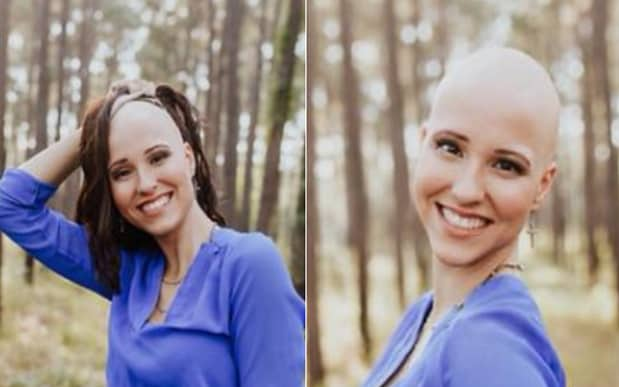 Makenzee Meaux was diagnosed with Alopecia Universalis aged 8  - The Frost Collective / Makenzee Meaux