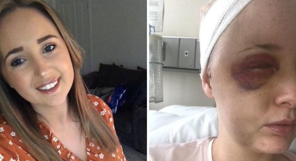 Emma Webster thought she had toothache, but was shocked when she was diagnosed with a brain tumour. (Emma Webster/SWNS)