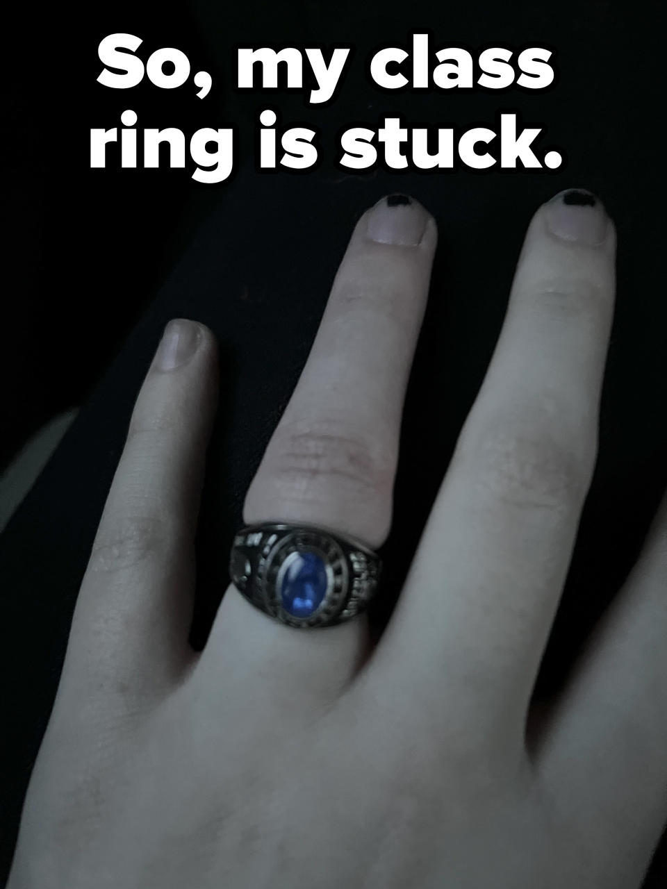 Close-up of a hand with a finger wearing a class ring with a large blue stone that looks very tight, with caption "So, my class ring is stuck"