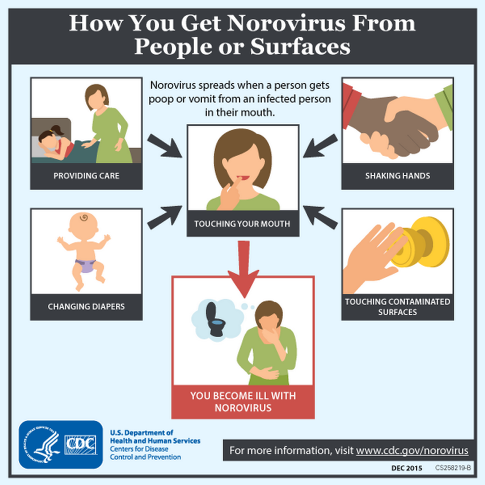 ‘California is humming with norovirus,’ knowledgeable says. What to learn about abdomen flu unfold