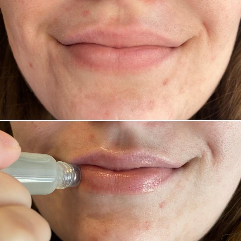 Reporter Amanda Krause's lips before using the Harry Styles lip oil, and after.