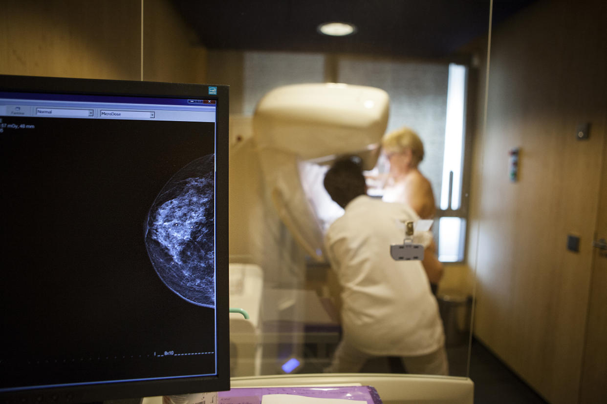 A technician carries out a routine mammogram. (Getty Images)