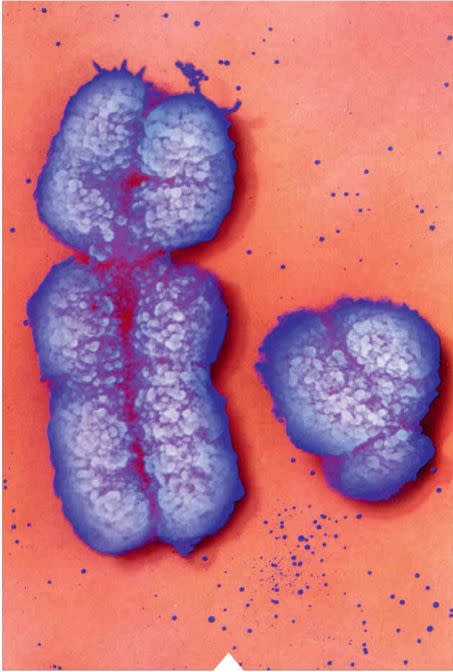 Les deux chromosomes sexuels masculins X (à gauche) et Y (à droite), vus au microscope et colorisés.