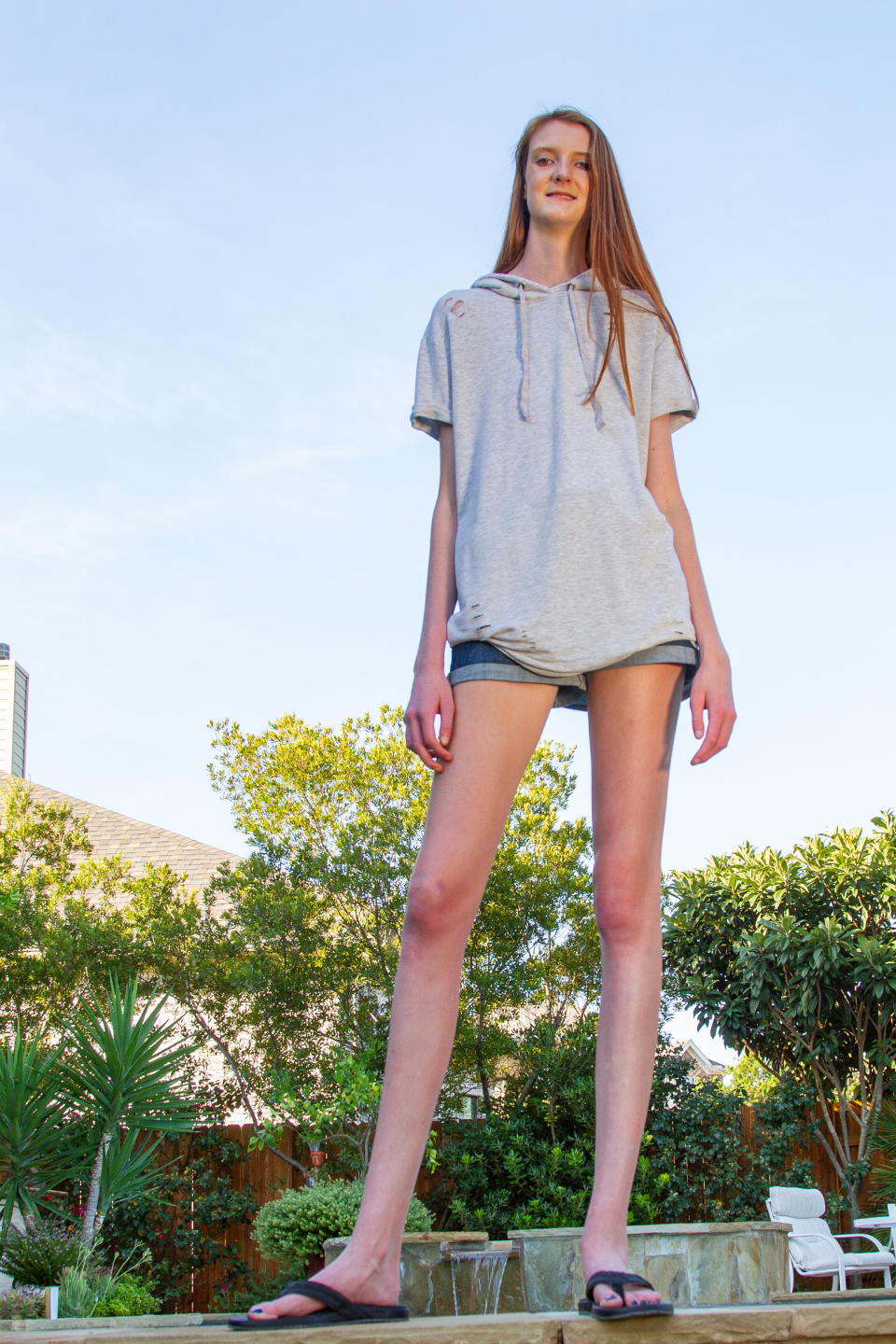 Teen Takes Longest Legs Record