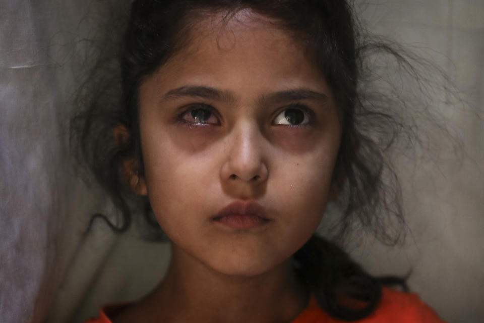 Six-year-old Muneefa Nazir, a Kashmiri girl whose right eye was hit by a marble ball shot allegedly by Indian Paramilitary soldiers on Aug. 12, stands outside her home in Srinagar, Indian controlled Kashmir, Sept. 17, 2019. The image was part of a series of photographs by Associated Press photographers which won the 2020 Pulitzer Prize for Feature Photography. (AP Photo/Mukhtar Khan)