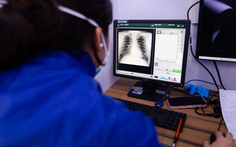 A health worker examines the chest x-ray of an inmate