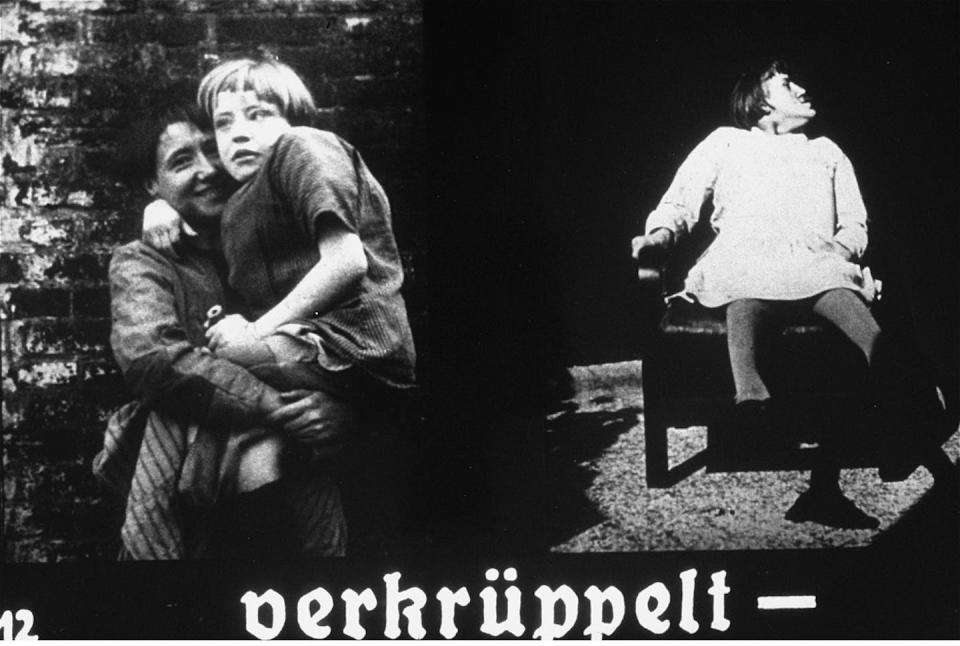 Nazi propaganda slide featuring two images of physically disabled children. The caption reads ‘deformed’. United States Holocaust Memorial Museum, courtesy of Marion Davy