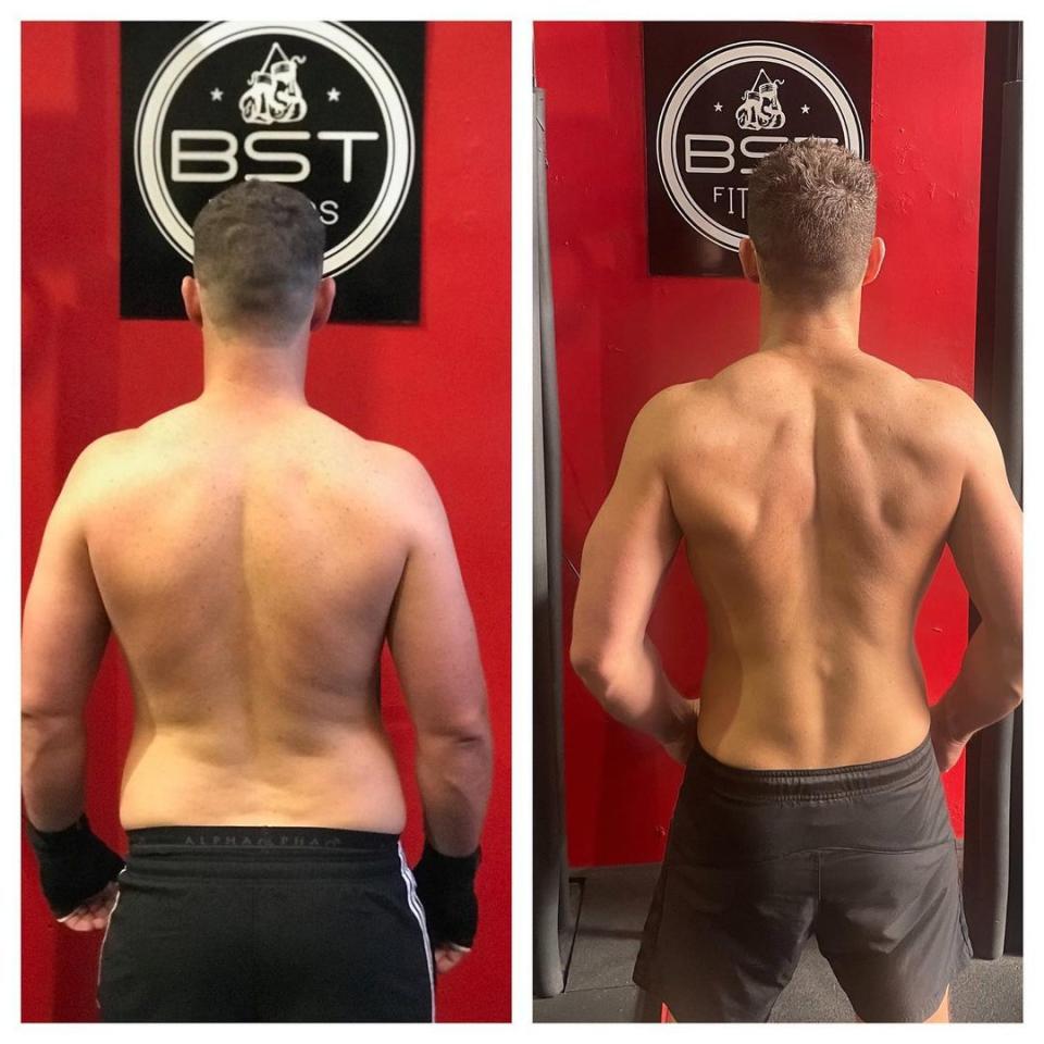 Michael Goonan's back before and after
