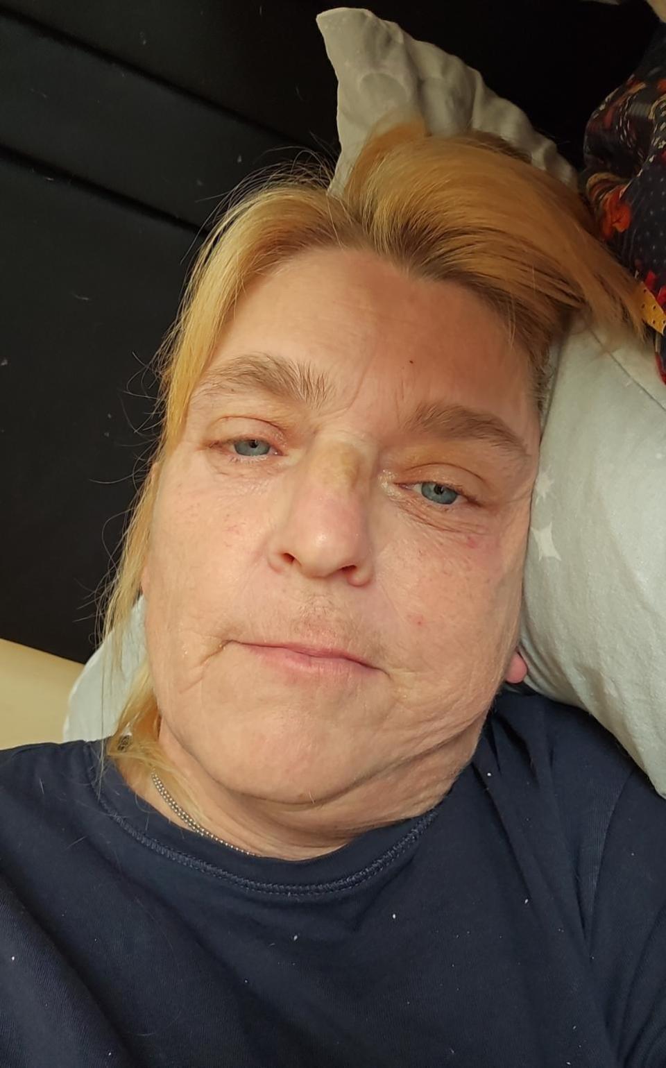 Gazette: Ordeal - Colchester Hospital patient Amanda Richardson, 55