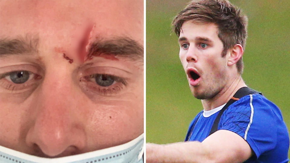 Ex-AFL player Ryan Bastinac has slammed local footy 'cowards' after he was headbutted in a match in Victoria last weekend. Pictures: Twitter/Getty Images