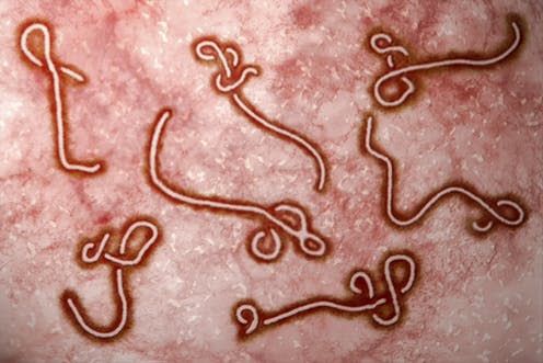 <span class="caption">Ebola virus.</span> <span class="attribution"><a class="link " href="https://www.shutterstock.com/download/confirm/210071416?src=I9_i9vjhquz_Ue6LUxgDYA-1-1&size=medium_jpg" rel="nofollow noopener" target="_blank" data-ylk="slk:Nixx Photography/Shutterstock;elm:context_link;itc:0;sec:content-canvas">Nixx Photography/Shutterstock</a></span>