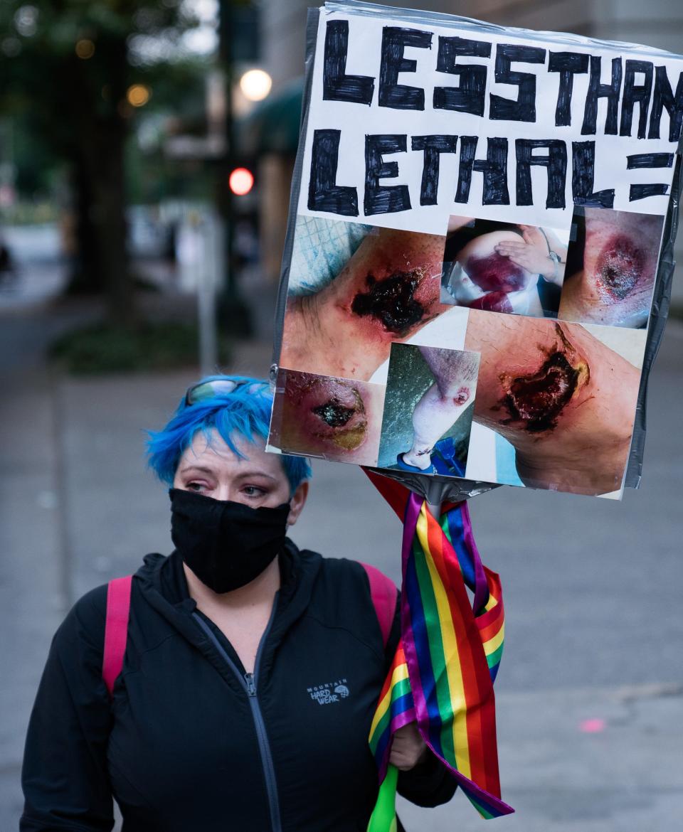 A protester holds a sign outside the federal courthouse in Portland, Oregon, on July 23, 2020, showing what she says are injuries suffered by protesters hit with less-lethal police weapons like paintball guns and rubber bullets.