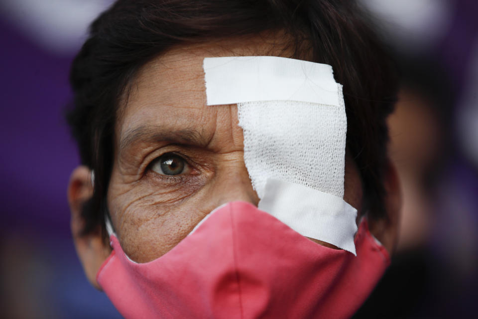 Una mujer con con un ojo tapado participa en una protesta contra la violencia de género, en Buenos Aires, Argentina, el miércoles 17 de febrero de 2021. (AP Foto/Natacha Pisarenko)