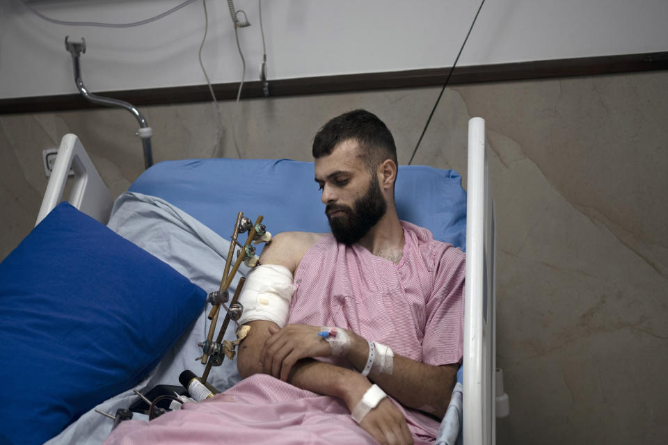 Mujahid Abadi, 24, recovers from gunshot wounds and burns at the Ibn Sina Specialized Hospital in the West Bank city of Jenin, Tuesday, June 25, 2024. When the Palestinian man stepped outside to see if Israeli forces had entered his uncle's neighborhood, he was shot in the arm and the foot. That was only the start of his ordeal. Hours later, beaten and bloodied, he found himself strapped to the searing hood of an Israeli military jeep driving down a road. (AP Photo/Maya Alleruzzo)