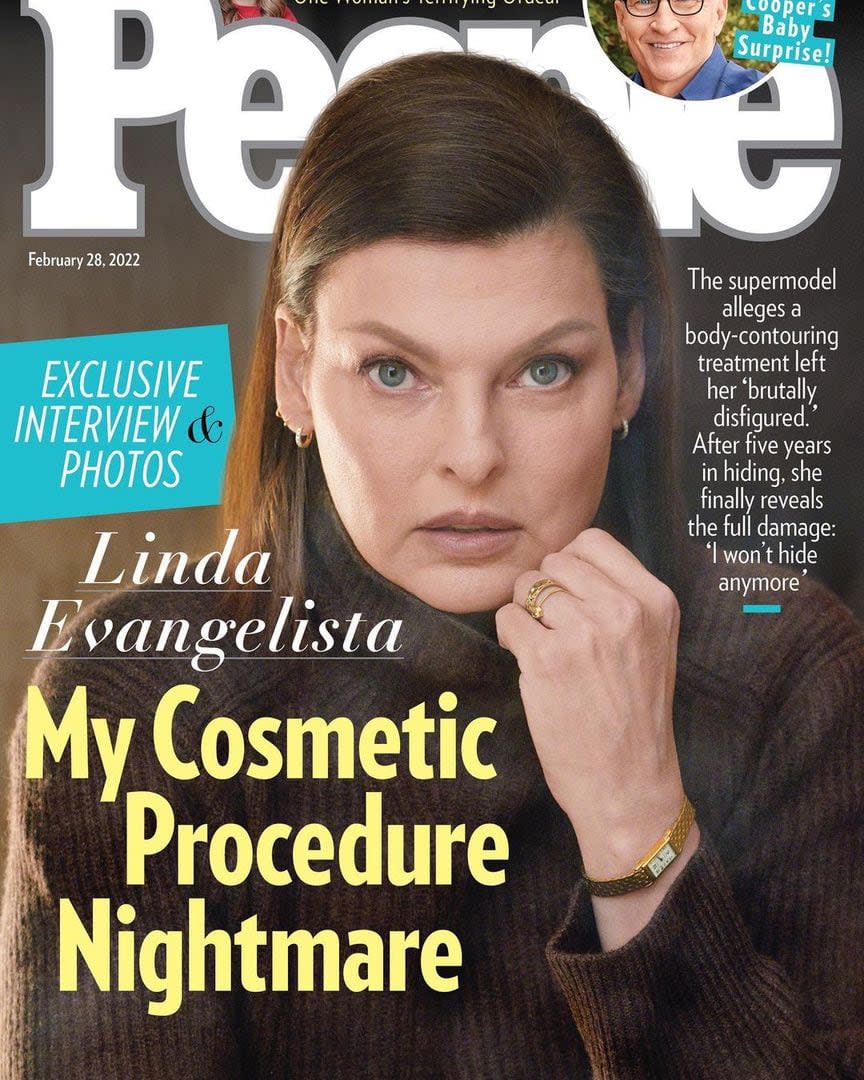 “La pesadilla de mi procedimiento cosmético”, así tituló People la entrevista de Linda Evangelista donde contó su calvario (Crédito: Instagram/@lindaevangelista)