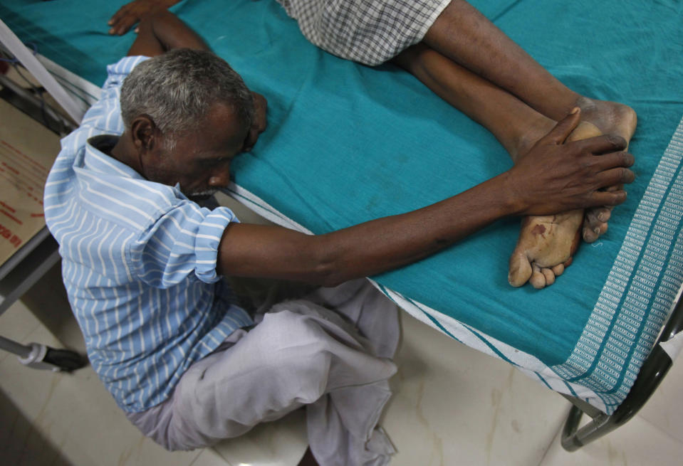 E. Takannan, left, holds on to feet of his unconscious son E. Manraj, 30, injured with burns on his head and hands, on a bed at a government run hospital in Madurai, southwest of Chennai, India, Thursday, Sept. 6, 2012. A massive blaze raged for hours at a fireworks factory in southern India, killing at least 40 workers and injuring 60 Wednesday, police said. Large amounts of firecrackers and raw materials had been stored in the Om Siva Shakti factory with major Hindu festivals weeks away. (AP Photo/Aijaz Rahi)