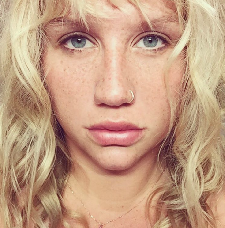 Kesha