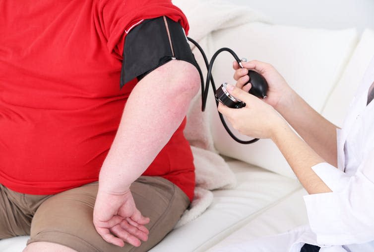 <span class="caption">Fat tissue can act as a reservoir for immune cells.</span> <span class="attribution"><a class="link " href="https://www.shutterstock.com/image-photo/doctor-examining-patient-obesity-on-light-187742627" rel="nofollow noopener" target="_blank" data-ylk="slk:Africa Studio/ Shutterstock;elm:context_link;itc:0;sec:content-canvas">Africa Studio/ Shutterstock</a></span>
