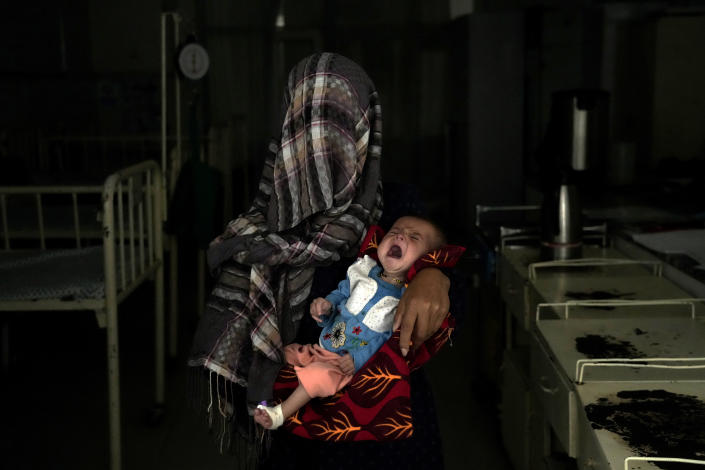 Nazia 30, who has lost four children due to severe malnutrition, holds her malnourished baby in a hospital in Parwan province north of Kabul, Afghanistan, Thursday, May 19, 2022. Some 1.1 million Afghan children under the age of five will face malnutrition by the end of the year. , as hospitals wards are already packed with sick children . (AP Photo/Ebrahim Noroozi)