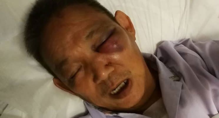 A 69-year-old man was allegedly assaulted by another man riding an e-bike. Source: Facebook/Hui Ying