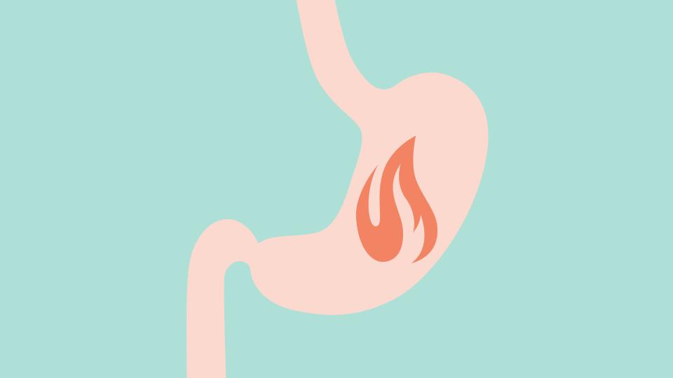 What exactly is heartburn, anyway?