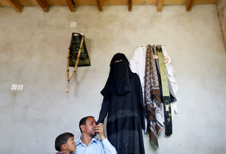 Khaled Ismael kisses the hand of his daughter, Radhiya, 17, who had her left arm amputated due to cancer, at their house in Amran, Yemen, August 10, 2018. "I spent all our valuables and had to borrow a lot of money to cover the expenses of my daughter's treatment. In the end, we couldn't afford a good treatment," Khaled Ismael said. "Because of our inability to travel abroad, my daughter did not get enough treatment and her arm had to be amputated," he added. "The war has devastated our lives." REUTERS/Khaled Abdullah