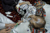 An acute malnourished boy is treated at the Indira Gandhi hospital in Kabul, Afghanistan, Sunday, May 22, 2022. Some 1.1 million Afghan children under the age of five will face malnutrition by the end of the year. , as hospitals wards are already packed with sick children . (AP Photo/Ebrahim Noroozi)